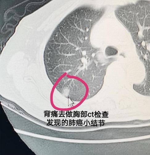 新冠肺炎最新形势深度解析